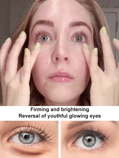 Gentian Anti-Wrinkle Eye Cream🔥 Last Day 49% OFF 🔥