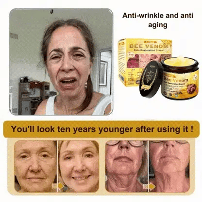 Mayo Clinic Official: AllyBee® Skin Treatment Cream Anti-aging, Hydrating, Skin Repair, Even Tone, Acne and Dark Spot Treatment, Wart and Mole Removal, Psoriasis Relief