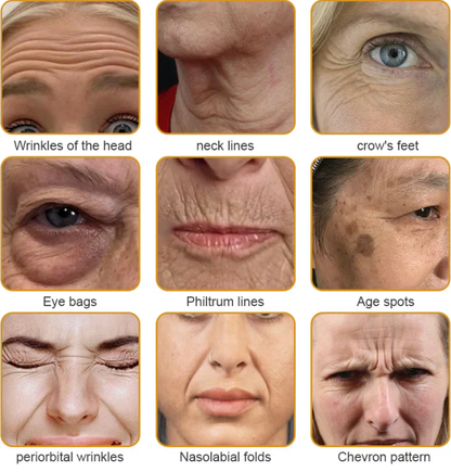 Mayo Clinic Official: AllyBee® Skin Treatment Cream Anti-aging, Hydrating, Skin Repair, Even Tone, Acne and Dark Spot Treatment, Wart and Mole Removal, Psoriasis Relief