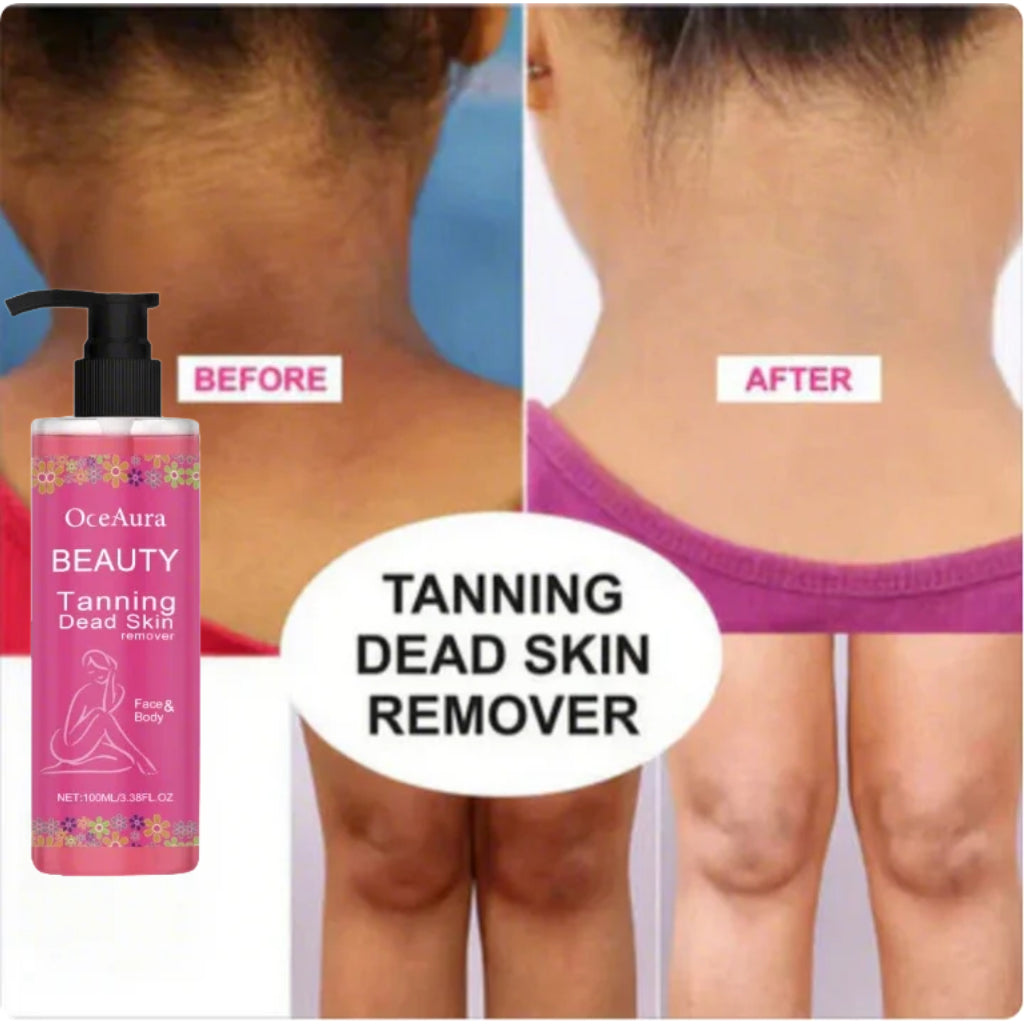 Dead Skin & Tan Remover for Smooth, Radiant Skin 🌞✨ (Buy 1 Get 1 Free🔥)
