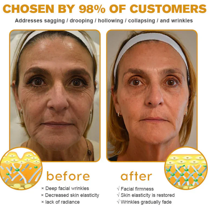 Mayo Clinic Official: AllyBee® Skin Treatment Cream Anti-aging, Hydrating, Skin Repair, Even Tone, Acne and Dark Spot Treatment, Wart and Mole Removal, Psoriasis Relief