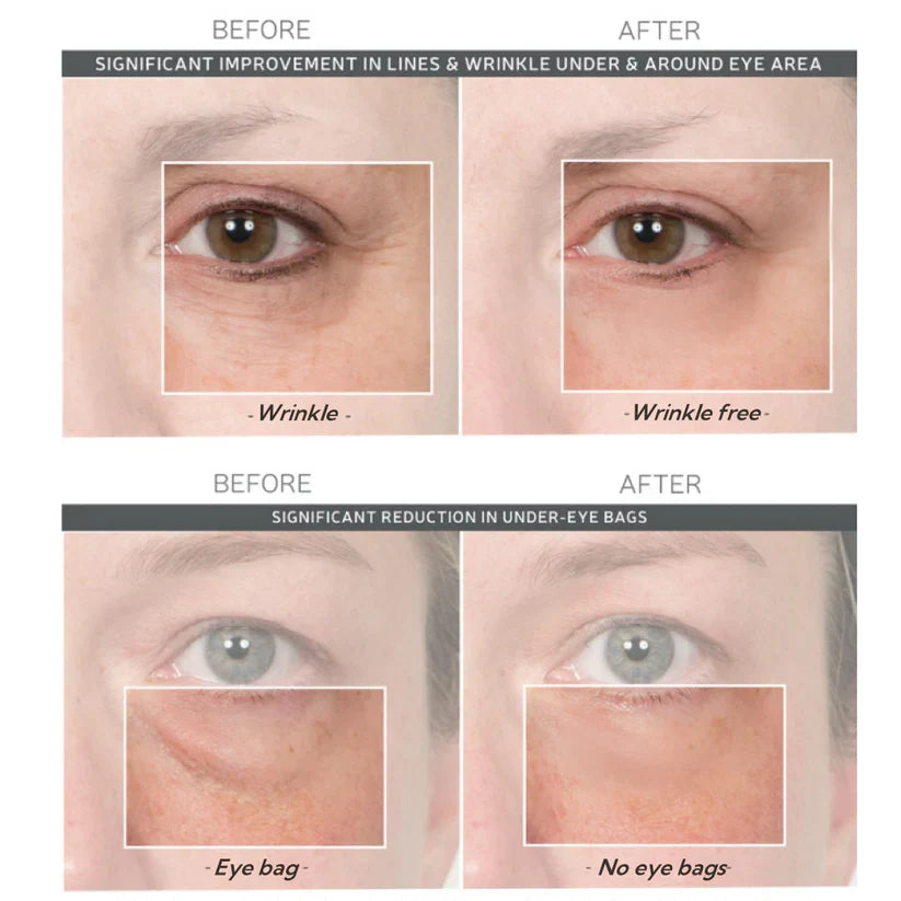 🚨𝑳𝑨𝑺𝑻 𝑫𝑨𝒀 𝑫𝑰𝑺𝑪𝑶𝑼𝑵𝑻: 𝟖𝟕% 𝑶𝑭𝑭 🔥 Instant Wrinkle Eye Tightener Cream