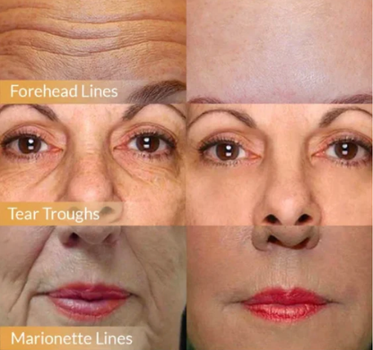 Crème visage raffermissante aux polypeptides - Transformez votre peau en une peau plus belle en 2 semaines