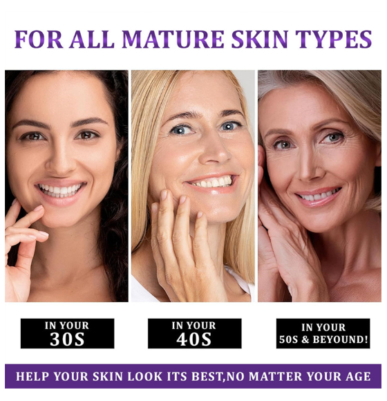 Lovilds Epiglow Melanev Advanced Anti Pigmentation Cream